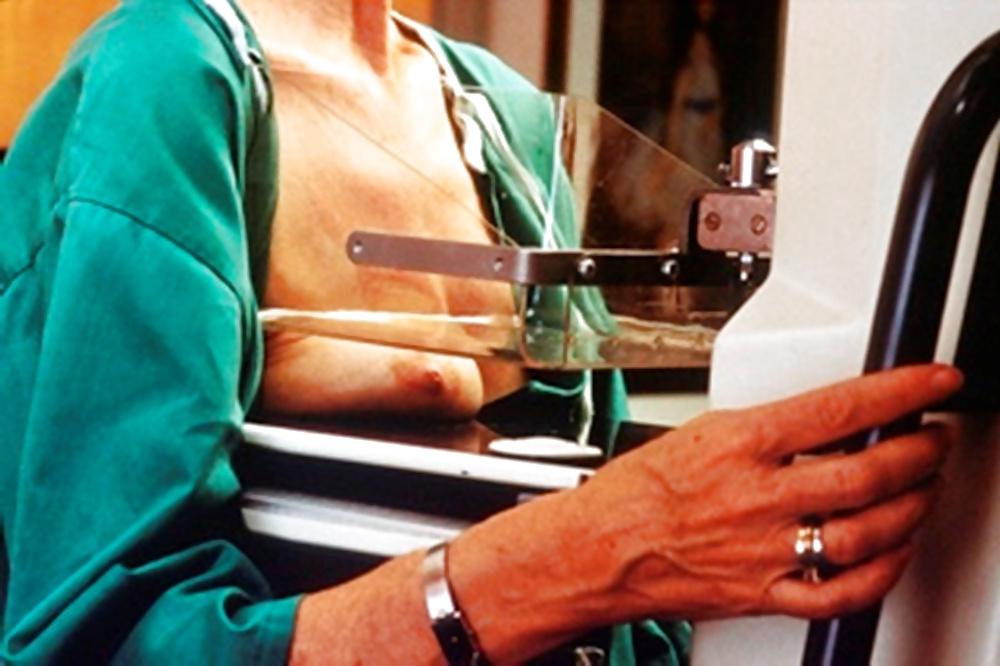 25P Women over 50 yo breasts exams prevention