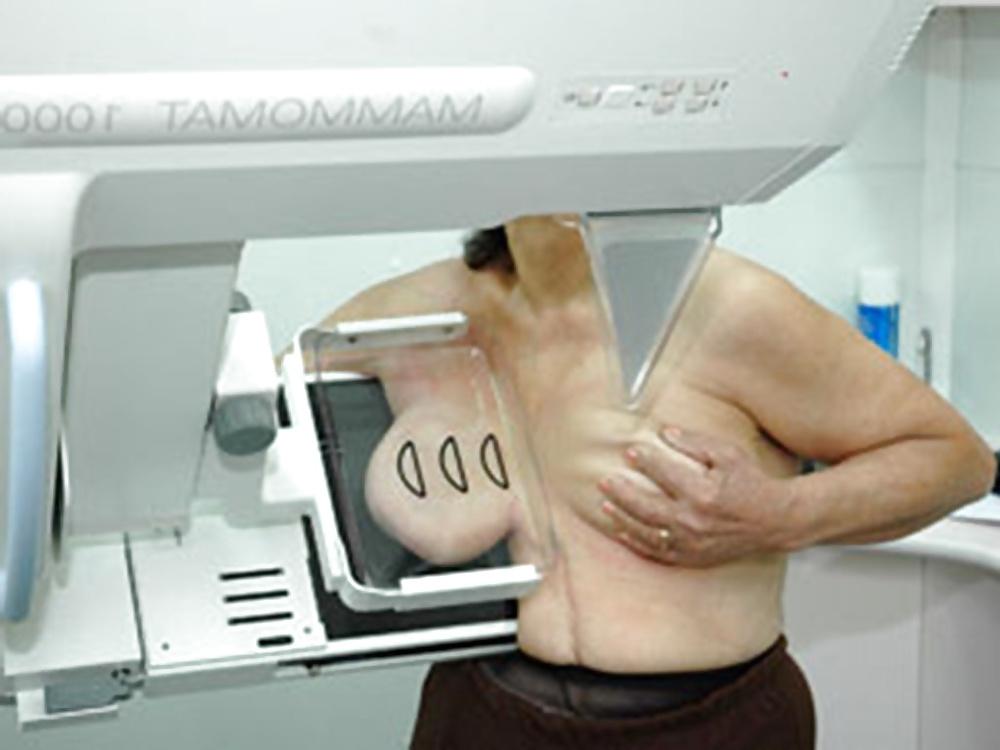 25P Women over 50 yo breasts exams prevention