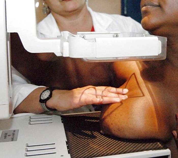 25P Women over 50 yo breasts exams prevention