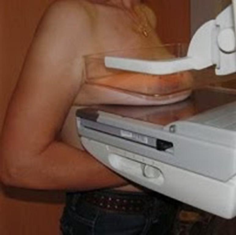 25P Women over 50 yo breasts exams prevention