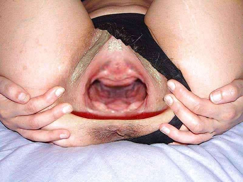 24P Glory holes