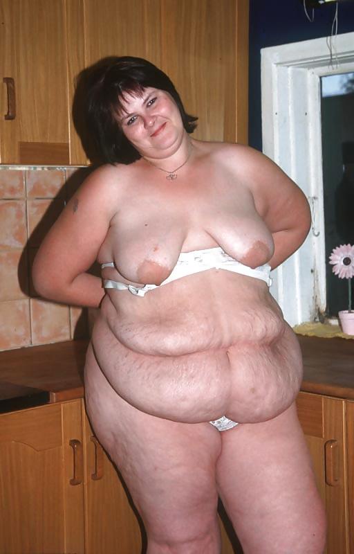 11P Hanging Belly and Cellulite