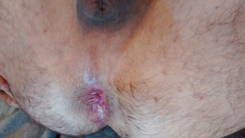 4P Gaping my asshole with my huge dildo!