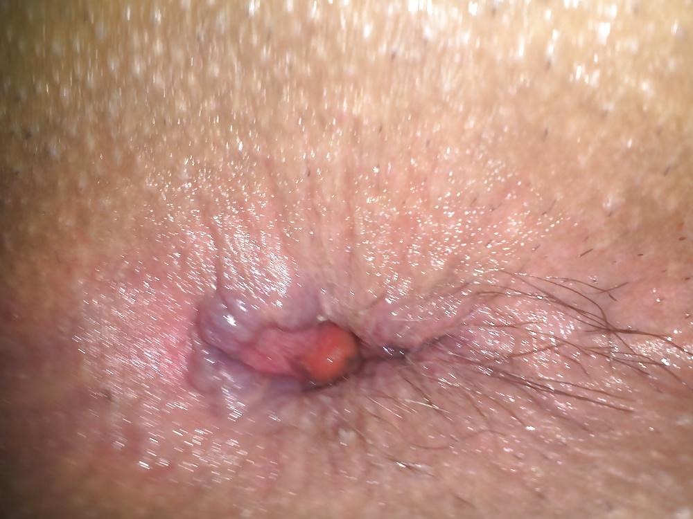 5P My asshole