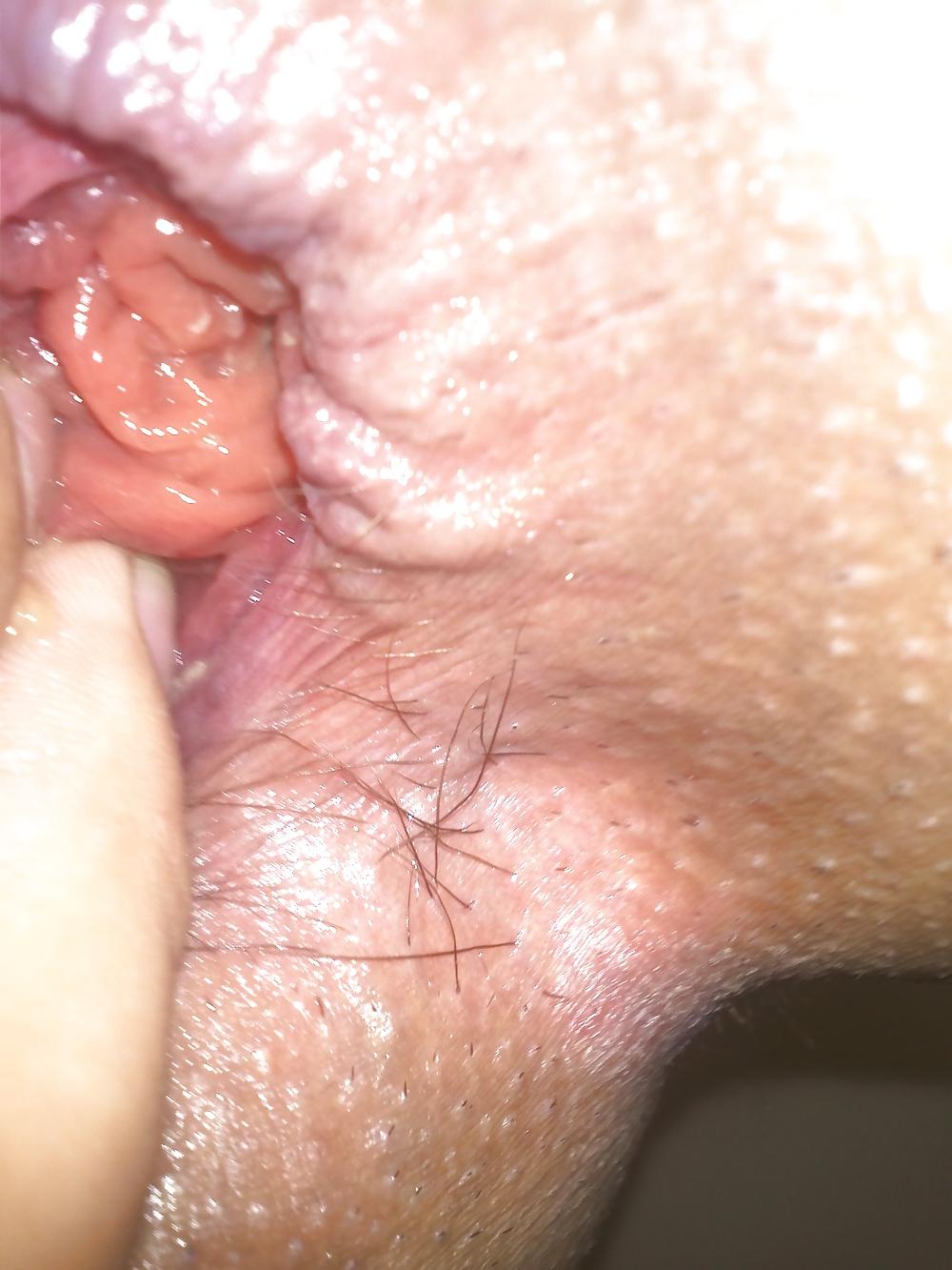 5P My asshole