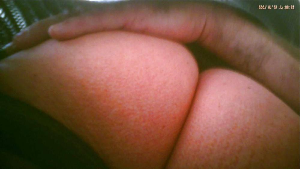 9P Other nurse upskirted : black stocking only under her dress
