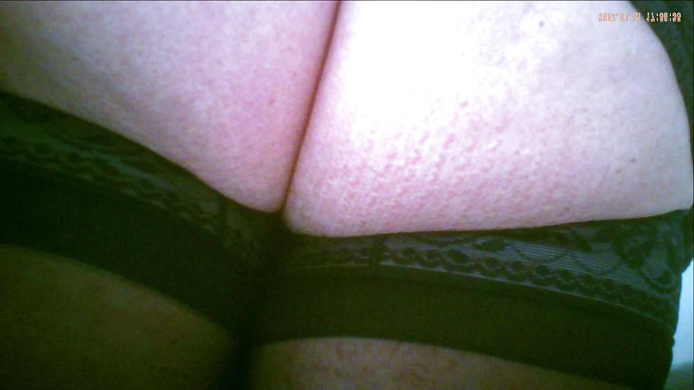 9P Other nurse upskirted : black stocking only under her dress