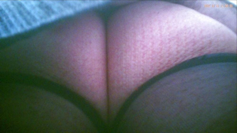 9P Other nurse upskirted : black stocking only under her dress