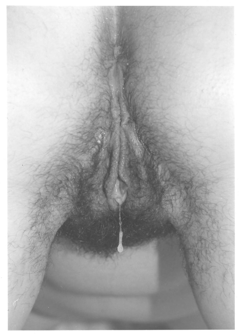 25P Zara Butt and Asshole pictures