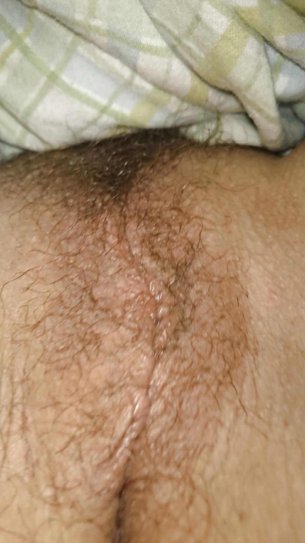 25P Up close of a beautiful hairy pussy
