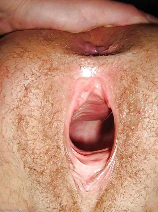25P Making Holes Expand