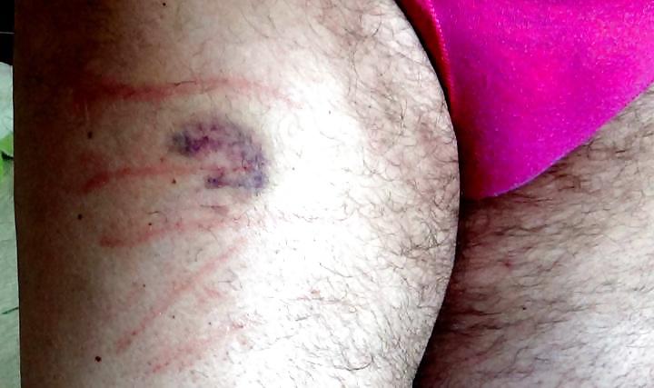 4P Caning Marks And Not Only
