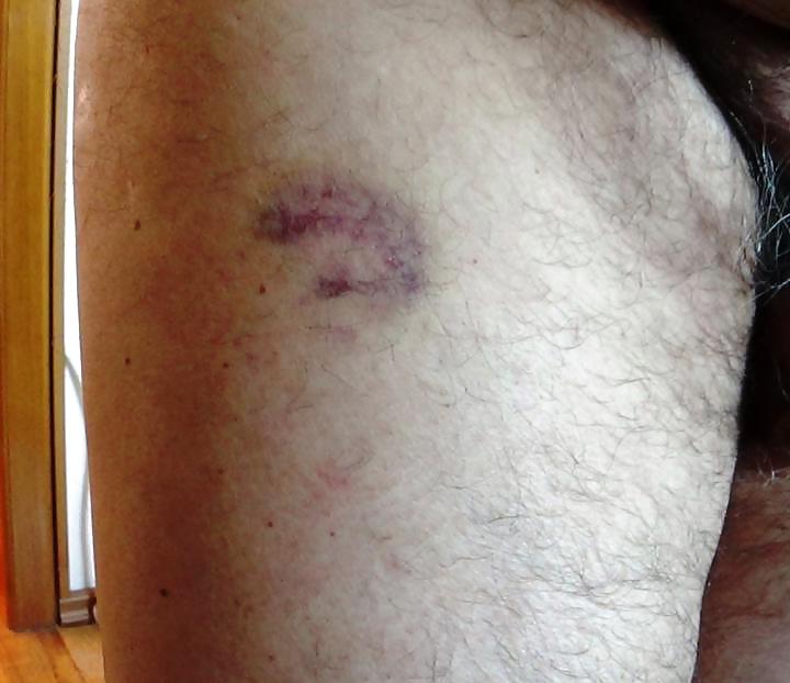 4P Caning Marks And Not Only