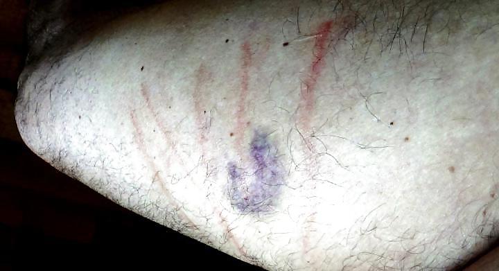 4P Caning Marks And Not Only
