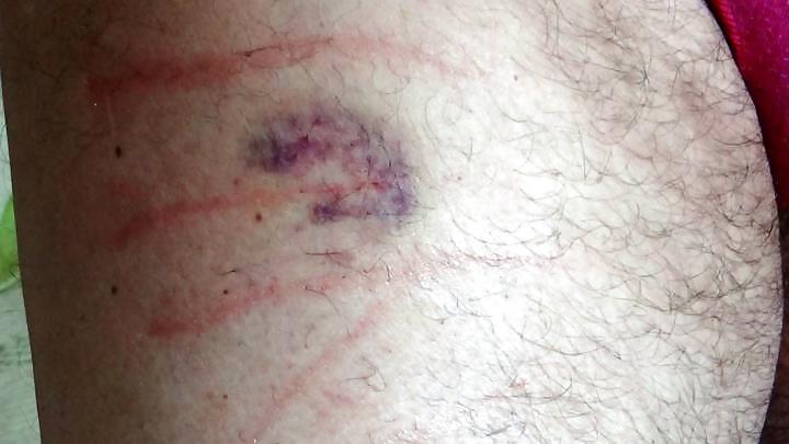 4P Caning Marks And Not Only