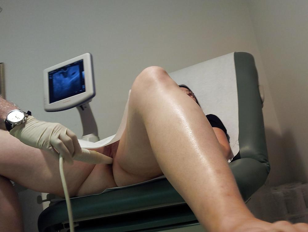 17P Voyeur Gyno