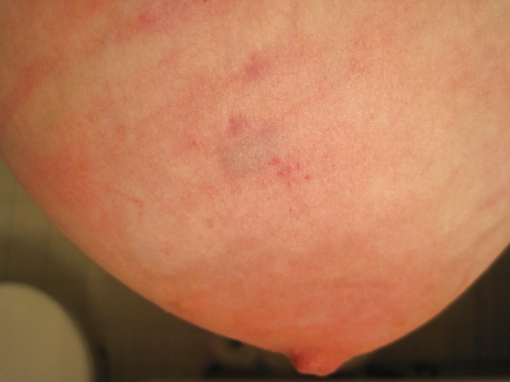 24P Caning whore tits