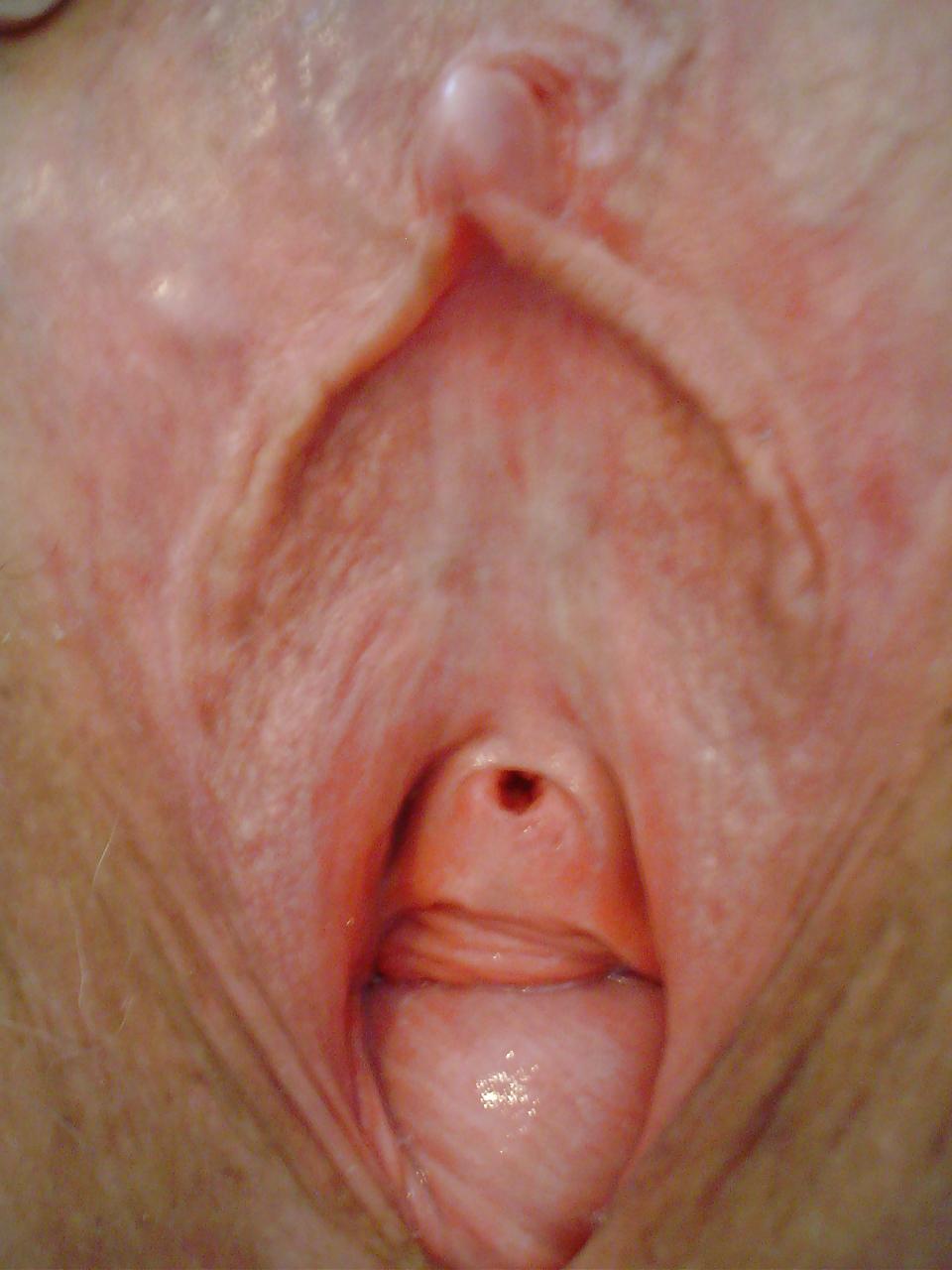25P Huge granny pussy