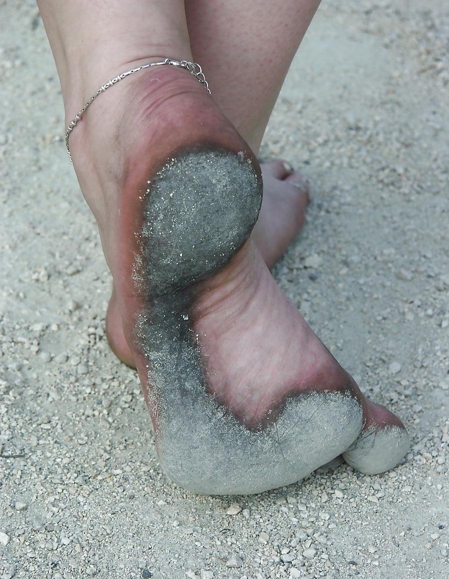25P Barefoot urban, dirty streets 1
