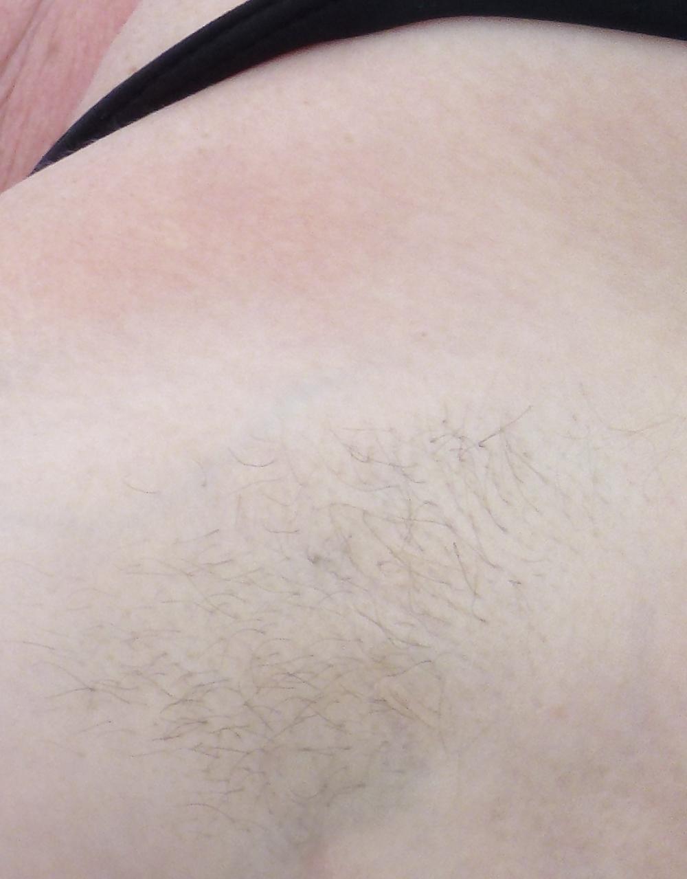 10P Hairy cunt my wife