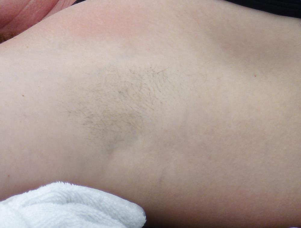 10P Hairy cunt my wife