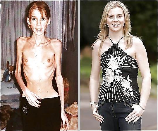 12P Skinny, Haut und Knochen ! Ist das noch sexy ?