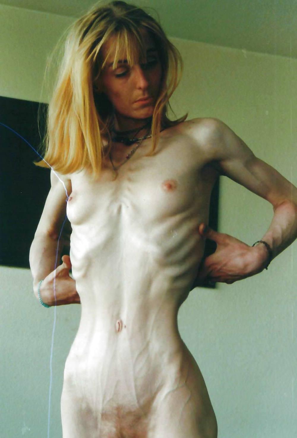 12P Skinny, Haut und Knochen ! Ist das noch sexy ?