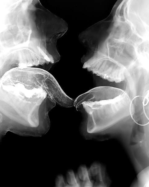 12P X-Ray