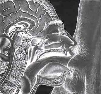 12P X-Ray