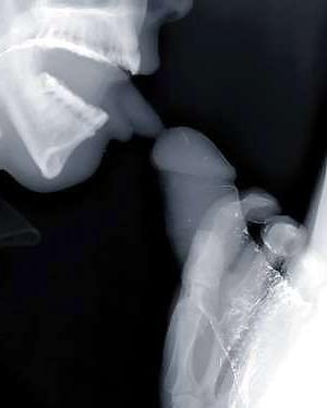 12P X-Ray