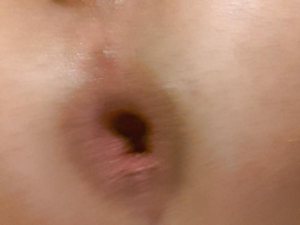18P My asshole