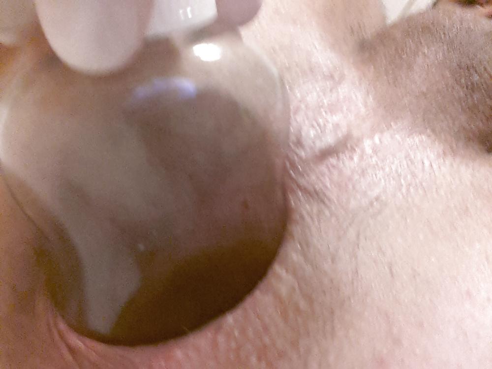 18P My asshole