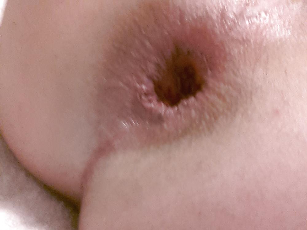 18P My asshole