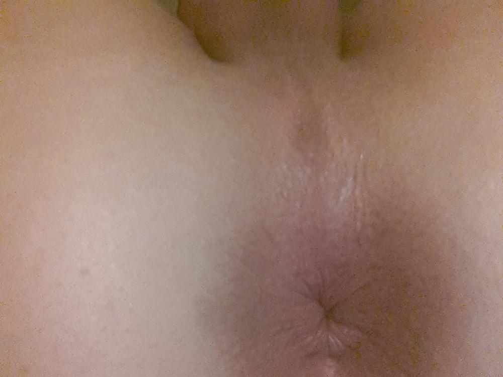 18P My asshole