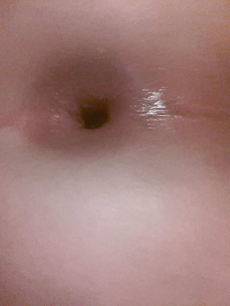 18P My asshole
