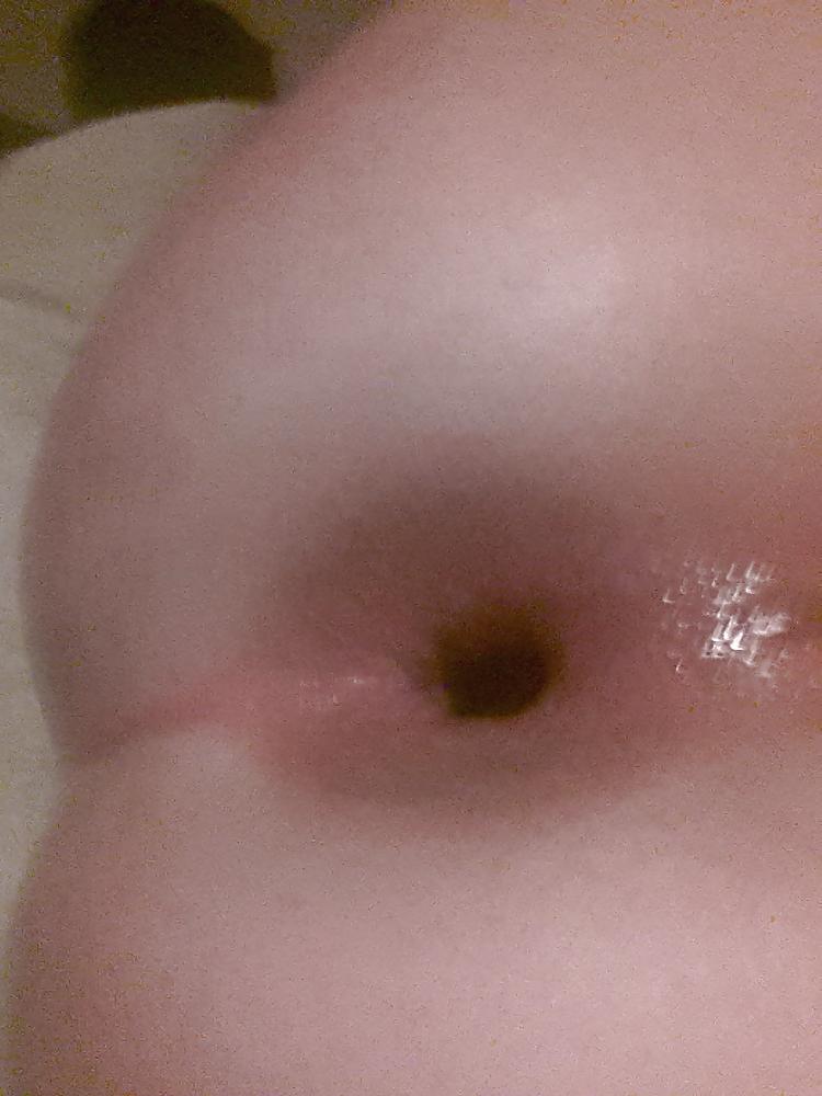 18P My asshole