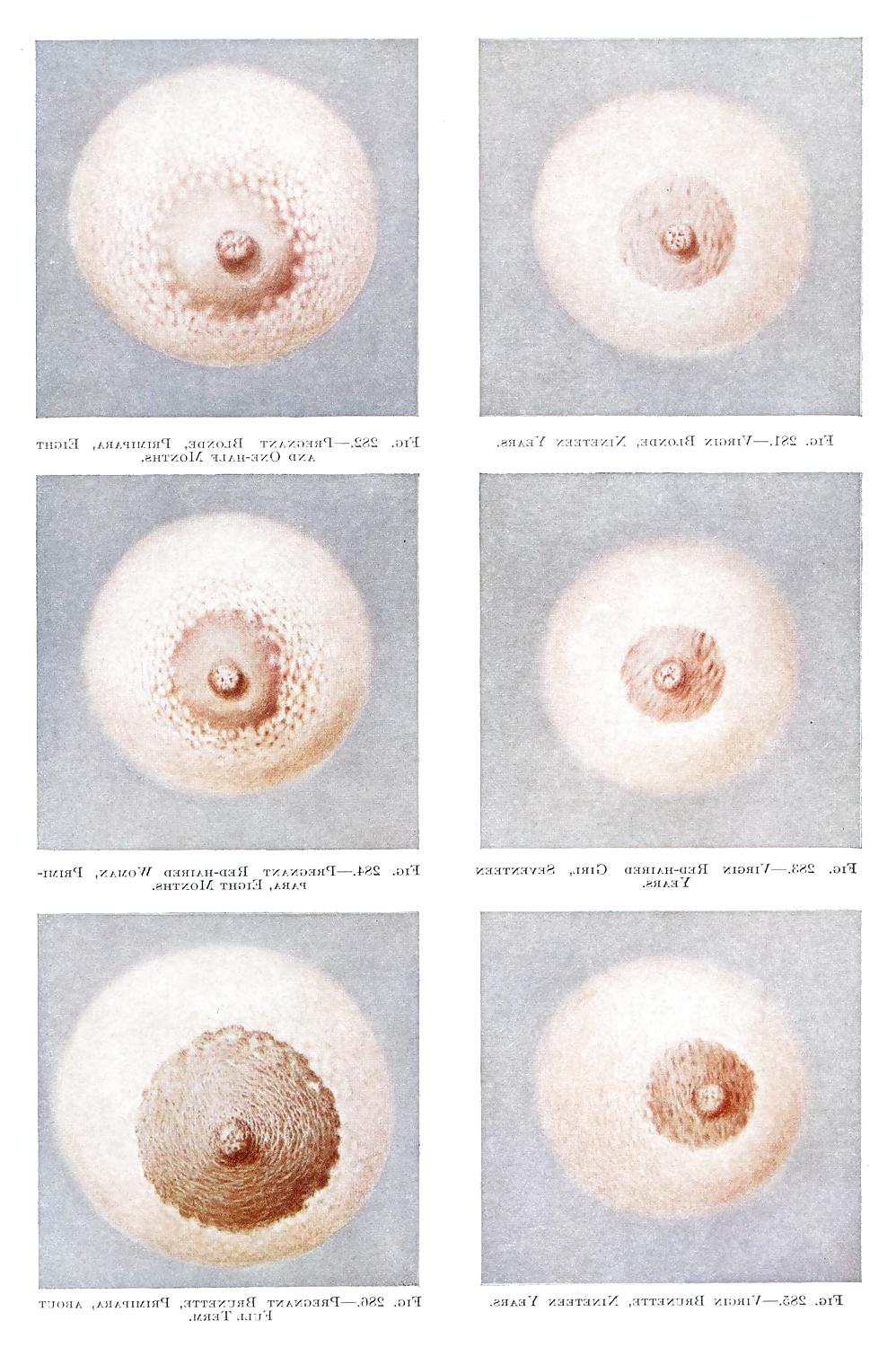 13P Nipples