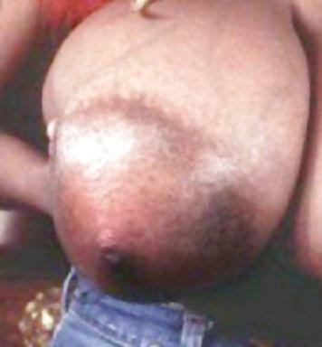 13P Nipples