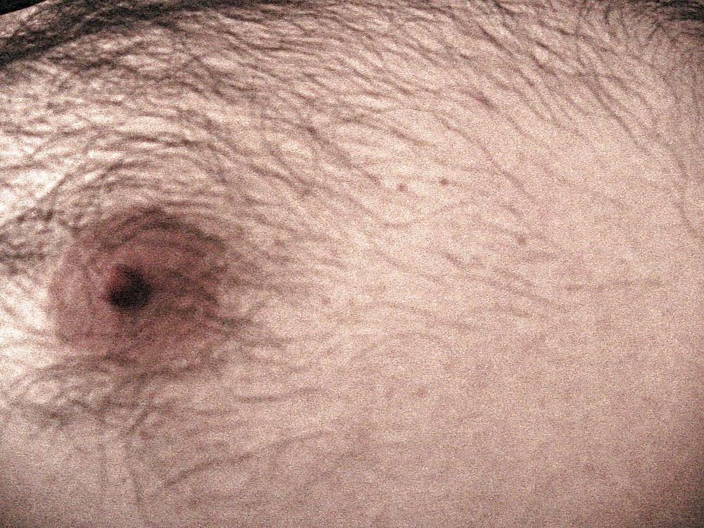 13P Nipples