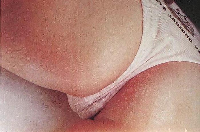 20P Cameltoe #2