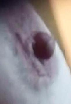 19P Nipples today