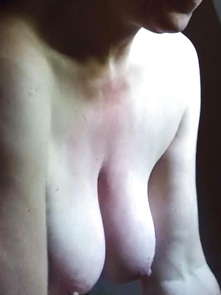 19P Nipples today
