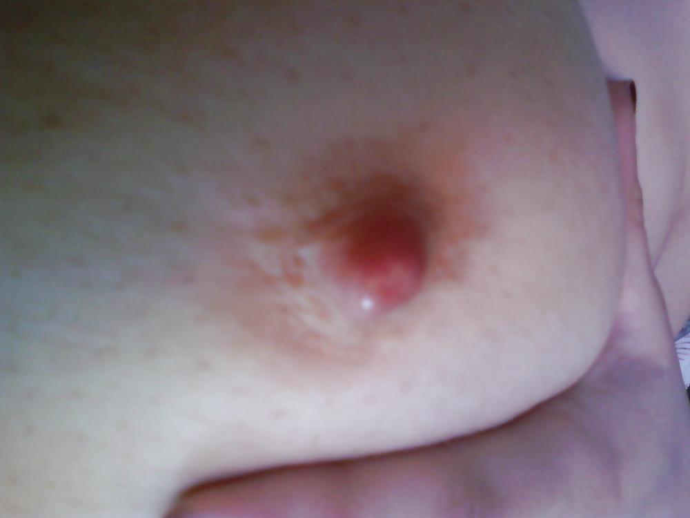 20P My girl friend sexy pussy
