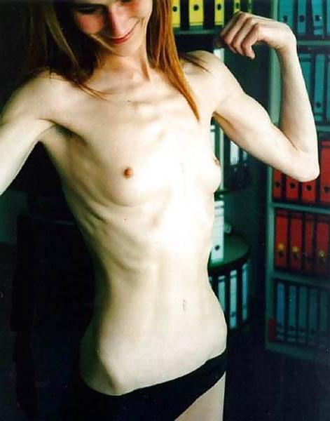 22P Skinny Girls