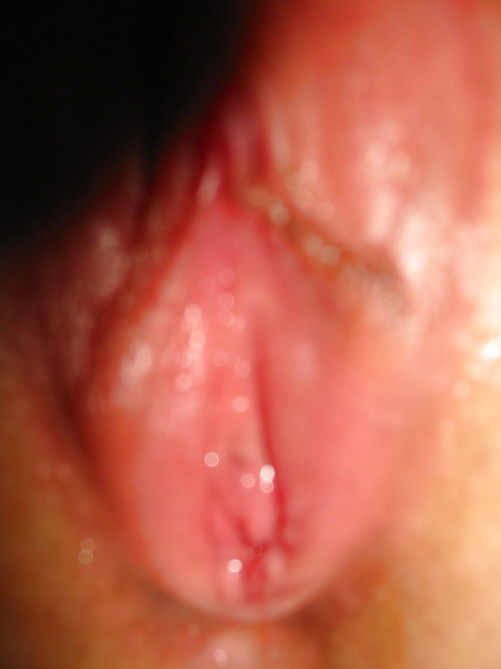 25P Cute CLIT