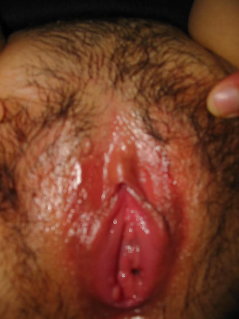 25P Cute CLIT