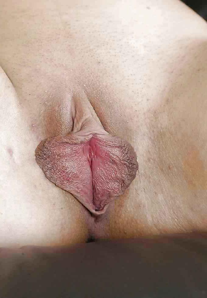 25P Huge Pussy Lips 4 