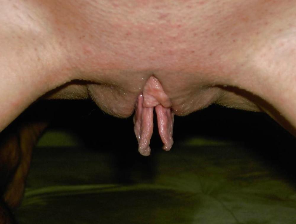 25P Huge Pussy Lips 6