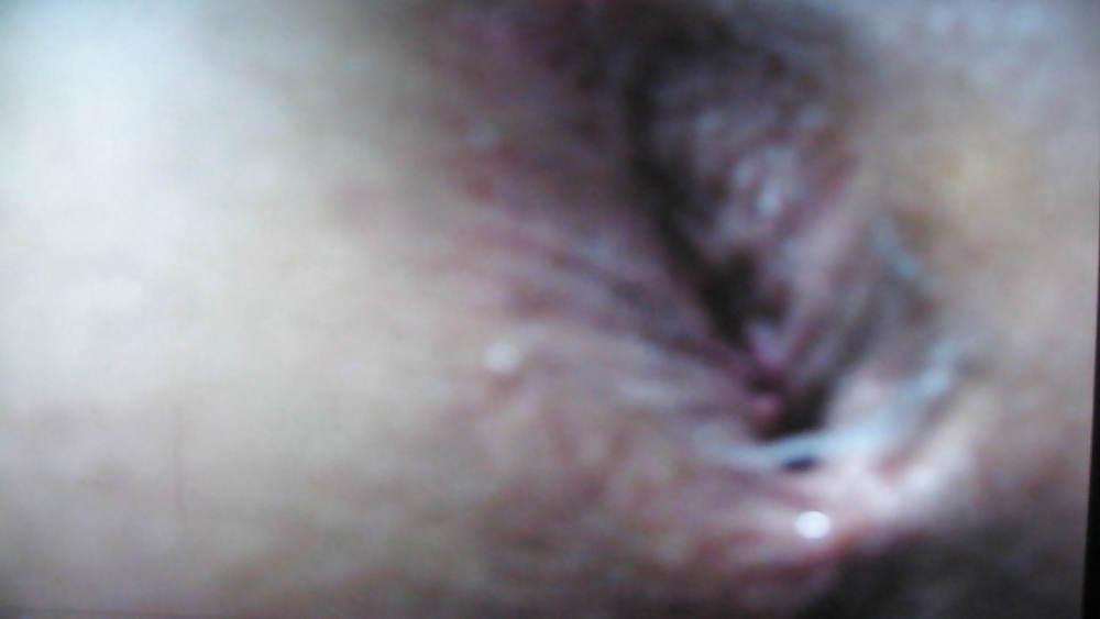 4P My asshole