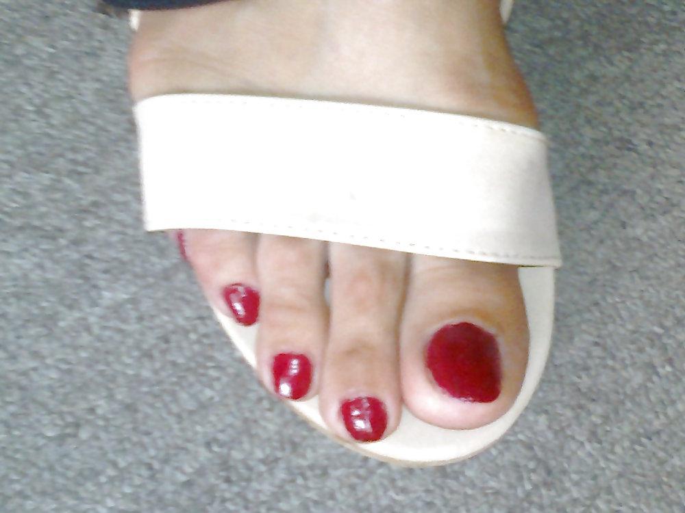 25P Toenails